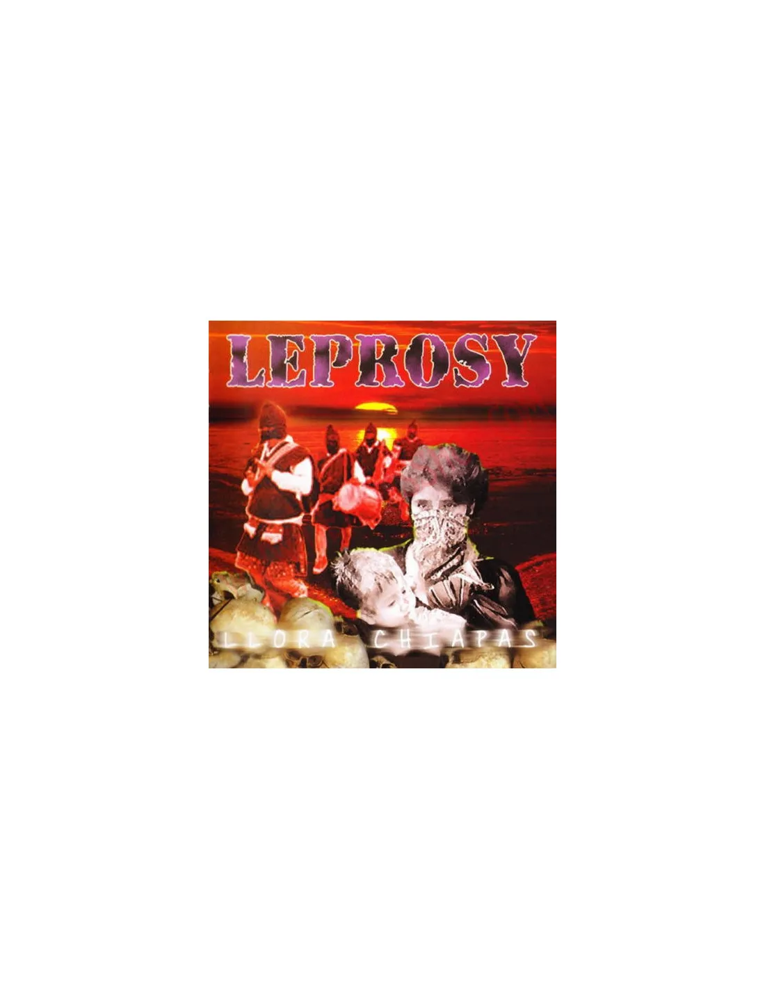 CD Leprosy – Llora Chiapas